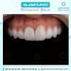 احسن عيادة لتيجان الاسنان في الامارات