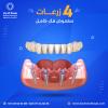 How do I know the success of dental implants?